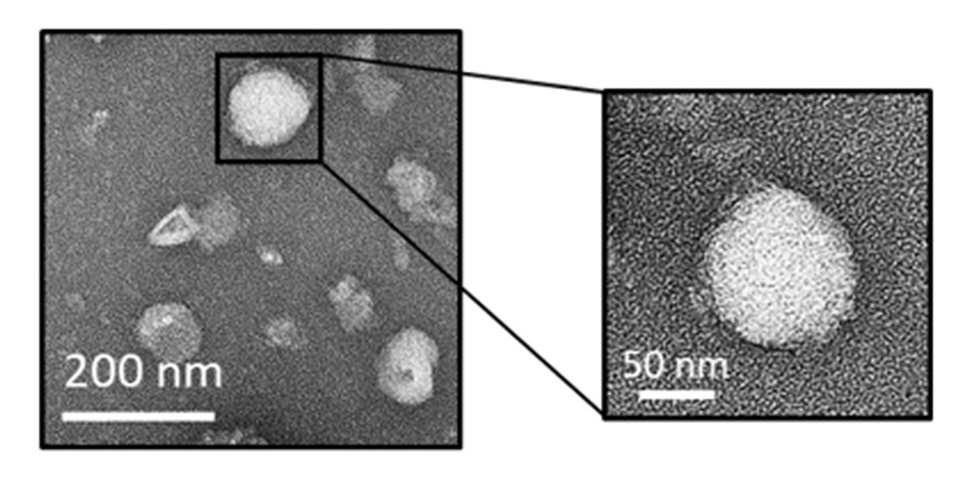 TEM image showing spherical exosome-like nanovesicles isolated from Purple Cabbage with uniform morphology.